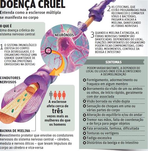 esclerose múltipla emagrece